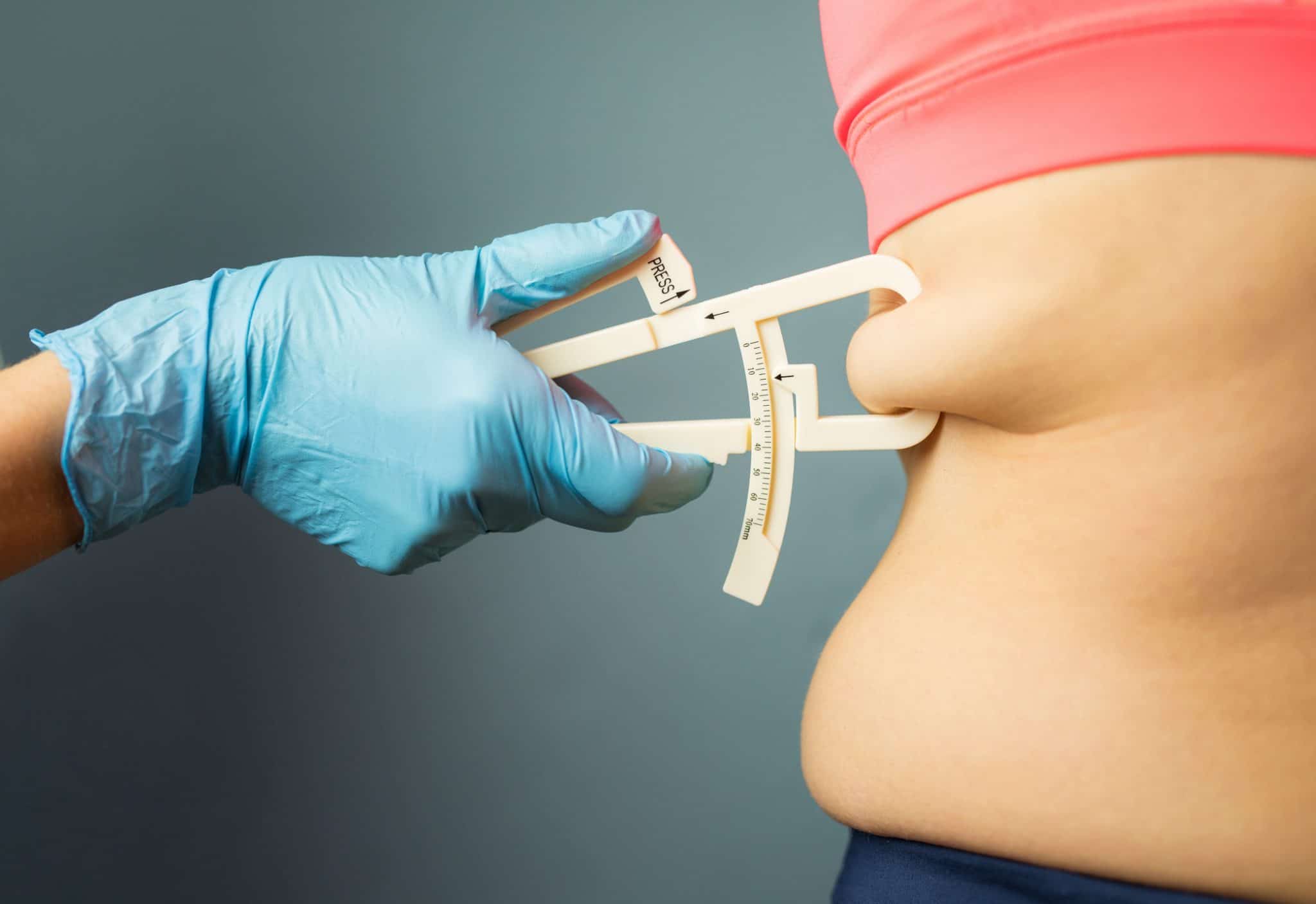 Obesidade é responsável por 10% das mortes por infecções no mundo, indica estudo