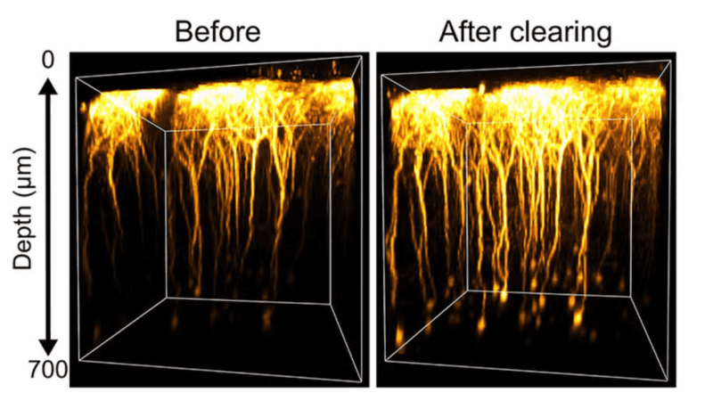 Proteína do sangue torna tecido cerebral temporariamente translúcido, diz estudo