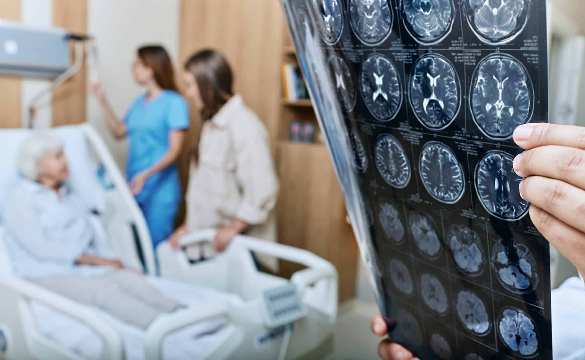 Exame de sangue detecta risco de demência até 25 anos antes dos sintomas