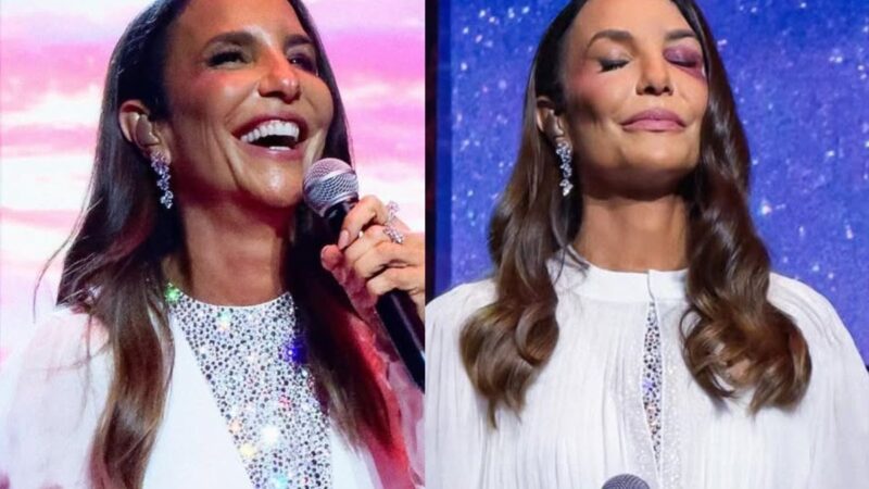 Ivete Sangalo anuncia cirurgia para a manhã de domingo após internação