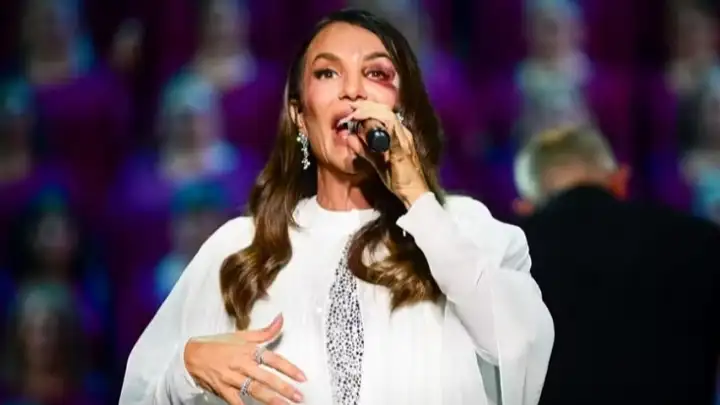 Ivete Sangalo retorna aos palcos com hematoma no rosto após desmaio em casa