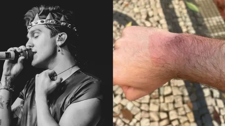 Fãs relatam queimaduras após uso de pulseiras de LED em show de Luan Santana em Belo Horizonte