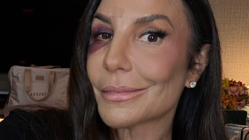 Ivete Sangalo atualiza fãs após cirurgia e mostra rosto inchado: “Tá bonito? Não tá bonito”