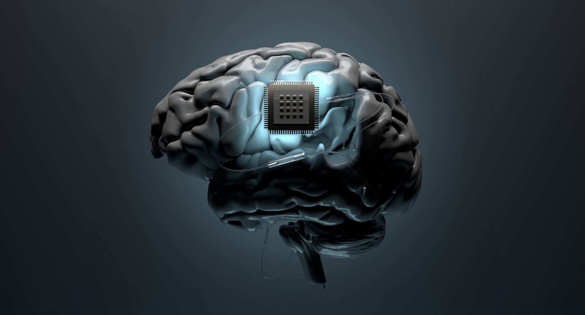 China libera primeiro implante cerebral invasivo para uso comercial