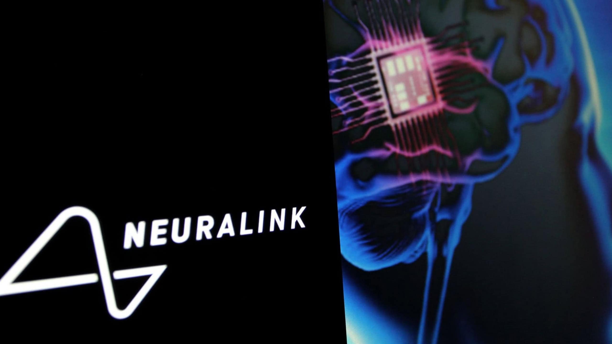 Neuralink enfrenta obstáculos para transformar chips cerebrais em produto real