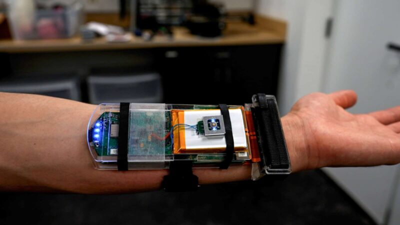 Pulseira com ultrassom do MIT rastreia movimentos da mão e pode controlar robôs