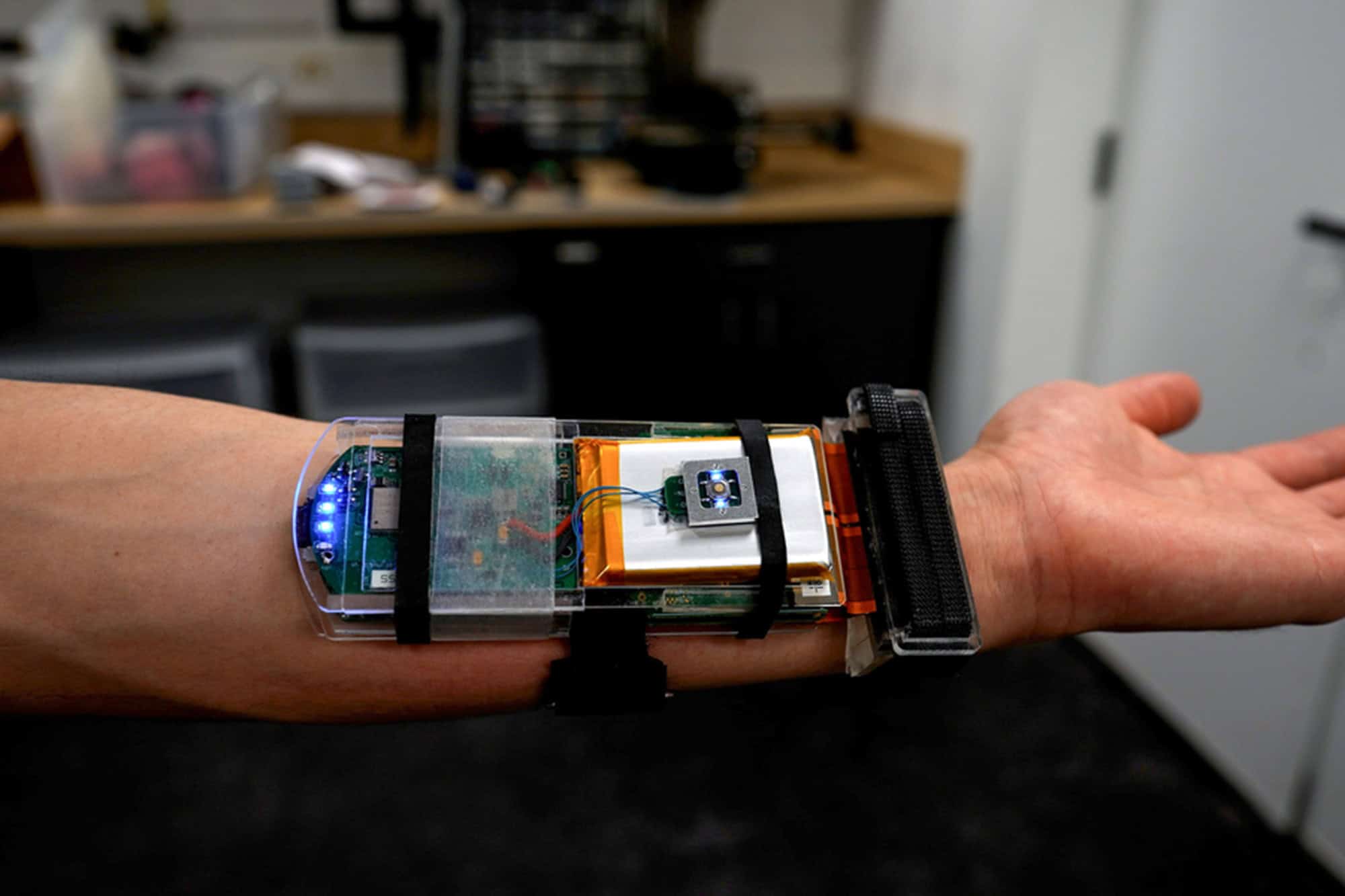 Pulseira com ultrassom do MIT rastreia movimentos da mão e pode controlar robôs