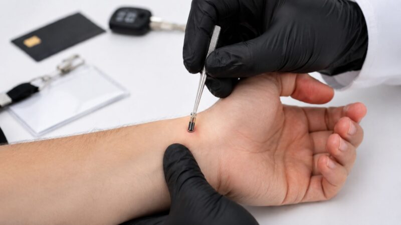 Chip do tamanho de um grão de arroz pode ser implantado entre os dedos para substituir cartões, chaves e armazenar dados médicos