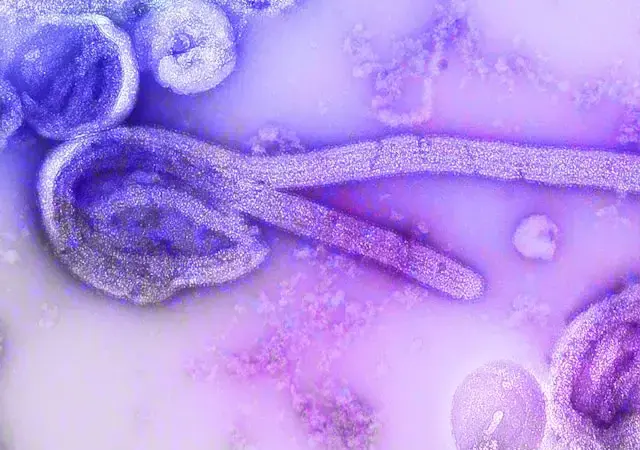 Entenda como sp investiga caso suspeito de ebola em paciente de 37 anos