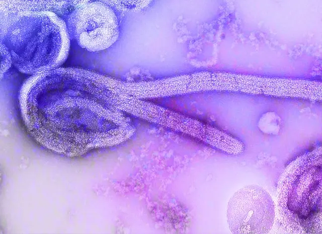 Entenda como sp investiga caso suspeito de ebola em paciente de 37 anos