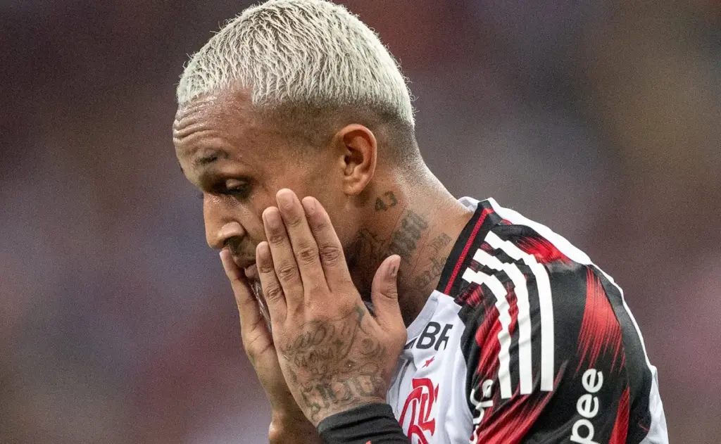 Veja como ex-flamengo, wesley é flagrado mancando muito após brasil x egito e eleva risco de corte