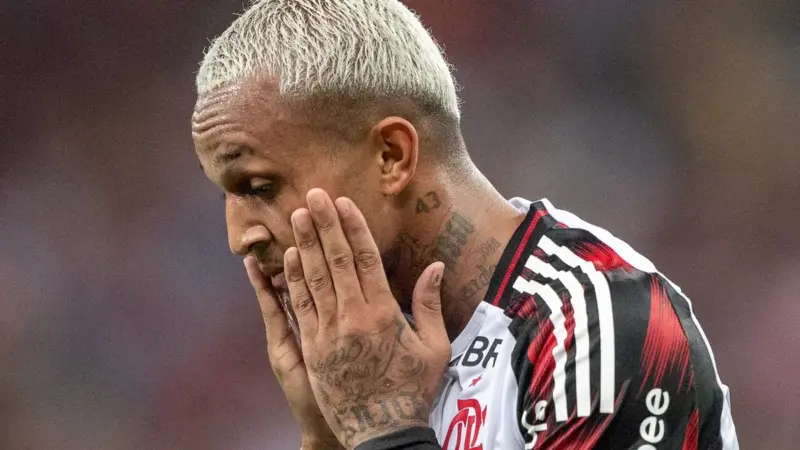 Veja como ex-flamengo, wesley é flagrado mancando muito após brasil x egito e eleva risco de corte