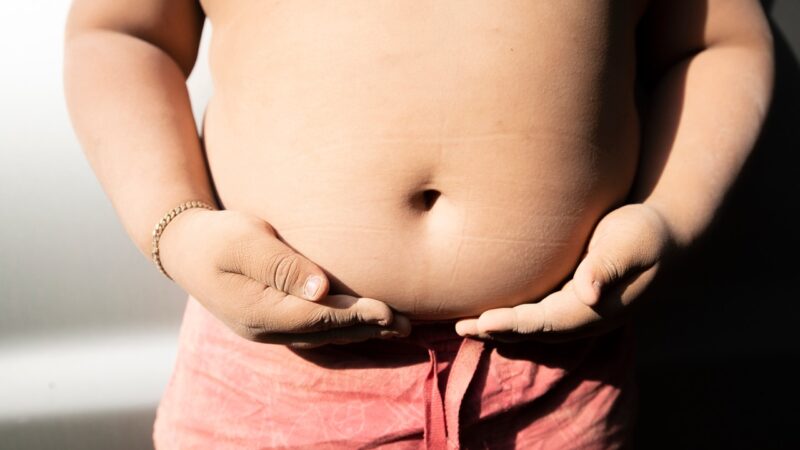 Conheça sem controle, obesidade na infância tende a se manter na adolescência