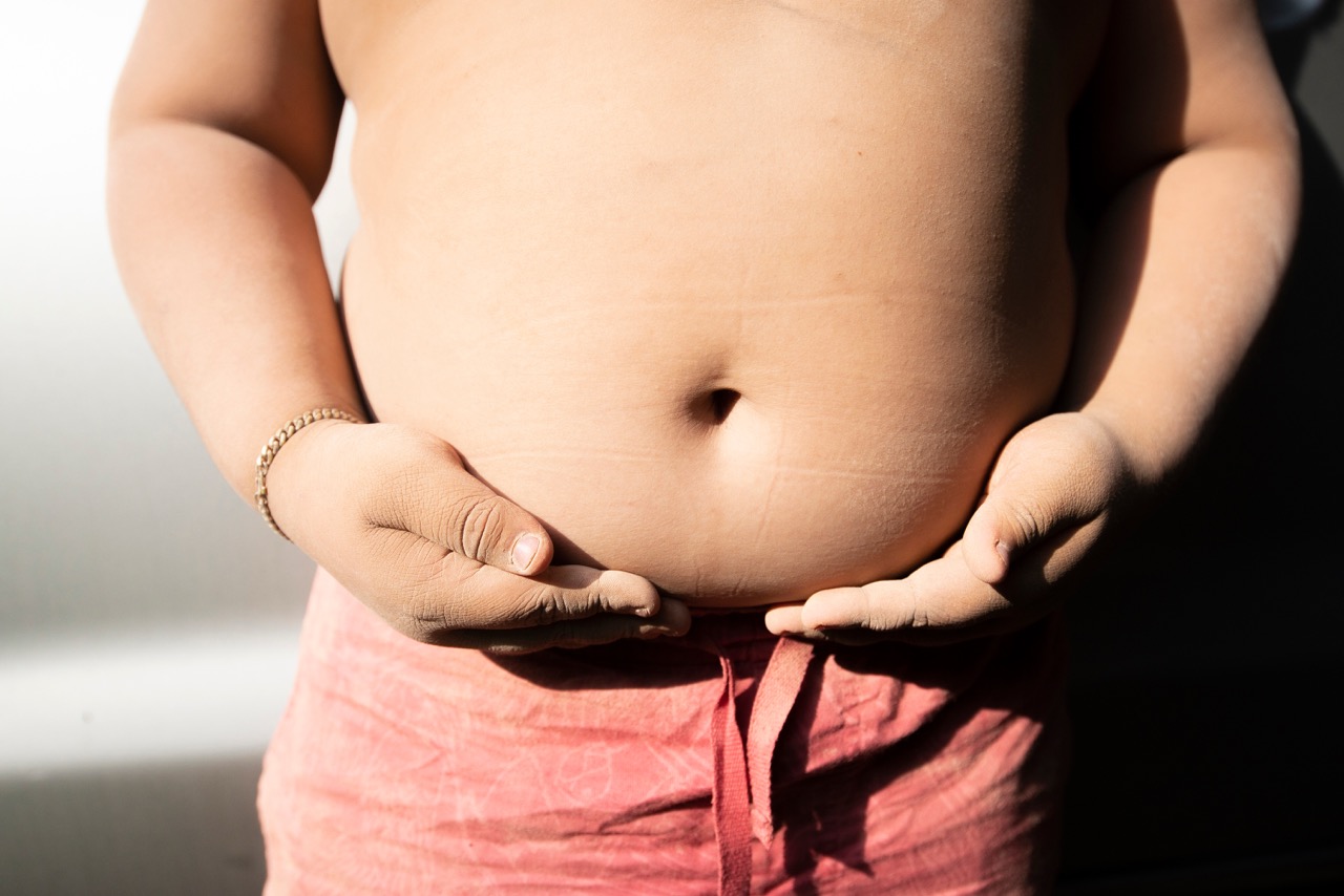Conheça sem controle, obesidade na infância tende a se manter na adolescência