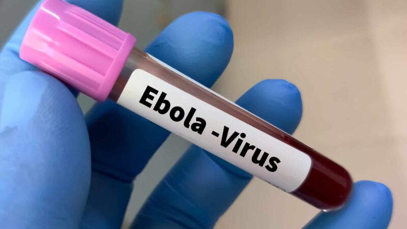 Universidade de Oxford inicia primeiro ensaio clínico humano de vacina contra o ebolavírus Bundibugyo
