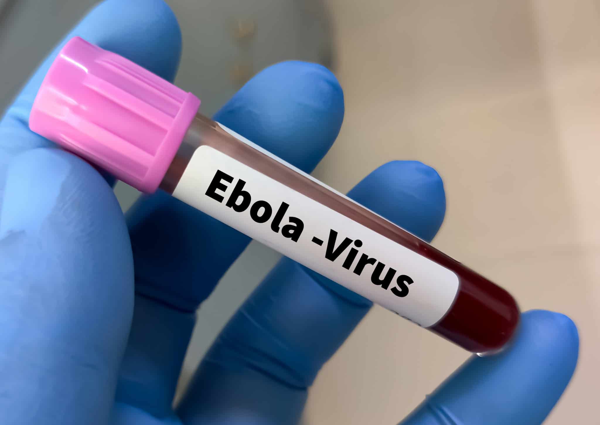 Universidade de Oxford inicia primeiro ensaio clínico humano de vacina contra o ebolavírus Bundibugyo