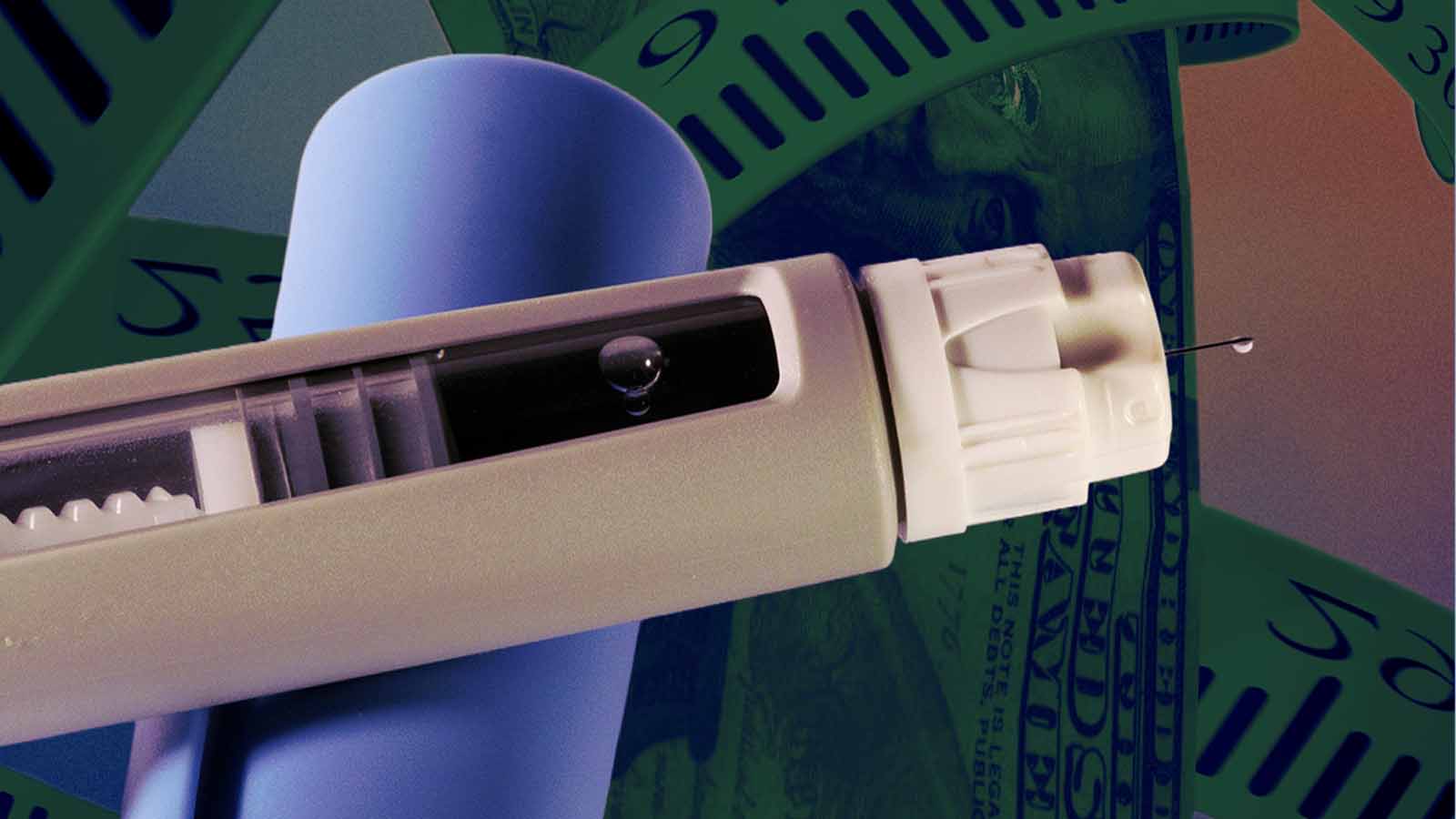 Estudo associa medicamentos GLP-1, como Ozempic, a maior probabilidade de queda de cabelo