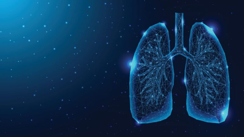 Hospital de São José do Rio Preto realiza primeira cirurgia pediátrica com ECMO